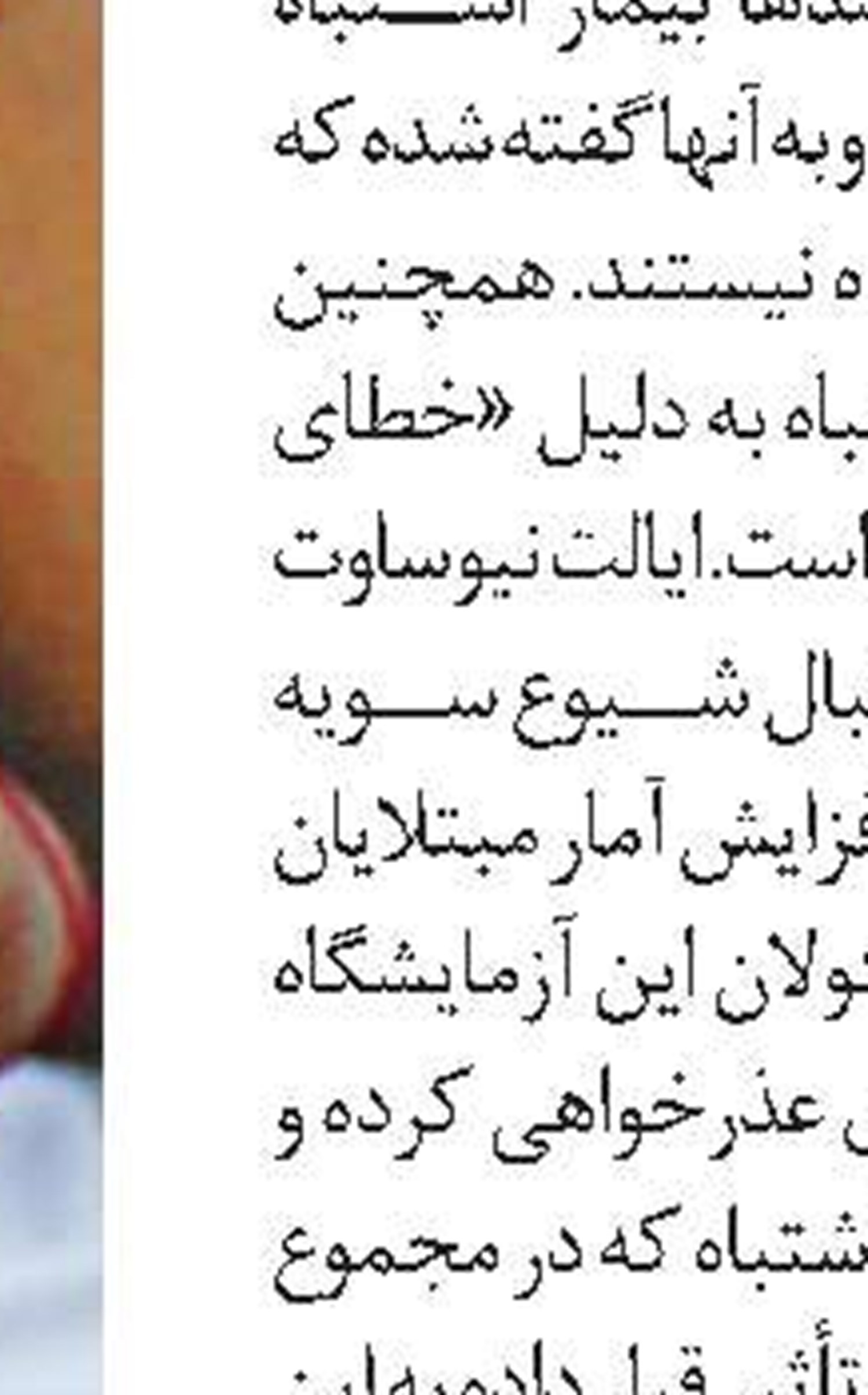 محدوديت حضور تماشاگران در فرانسه 