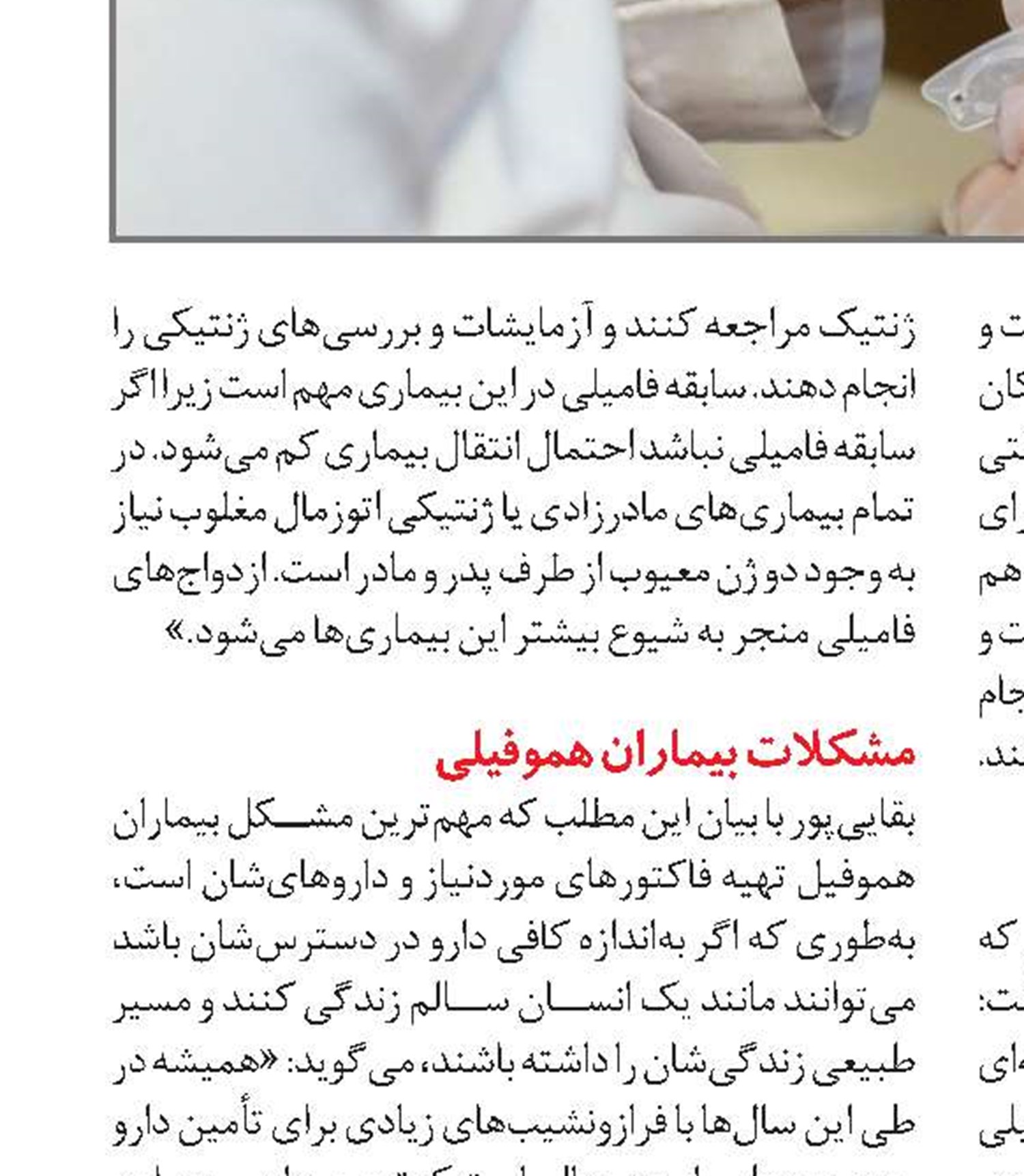ذرات پلاستیک مواد غذایی به مغز راه می‌یابند