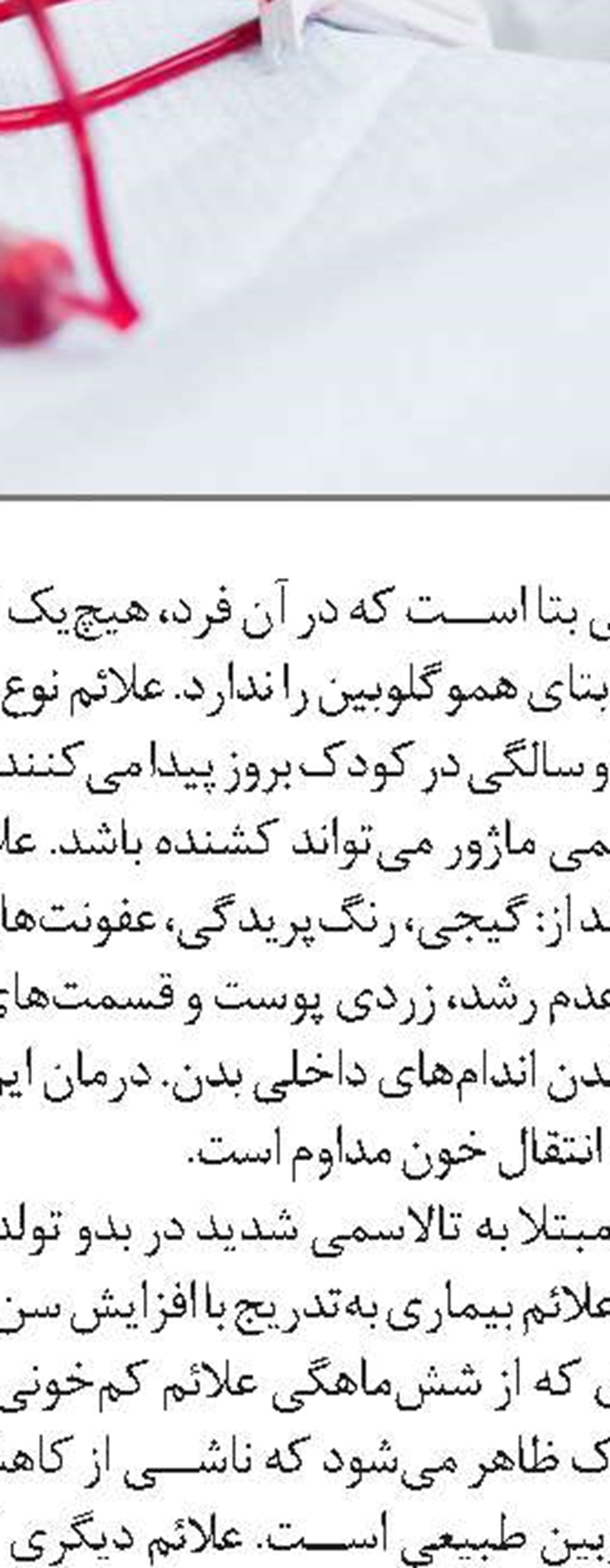 هوش مصنوعی رادیولوژیست شد