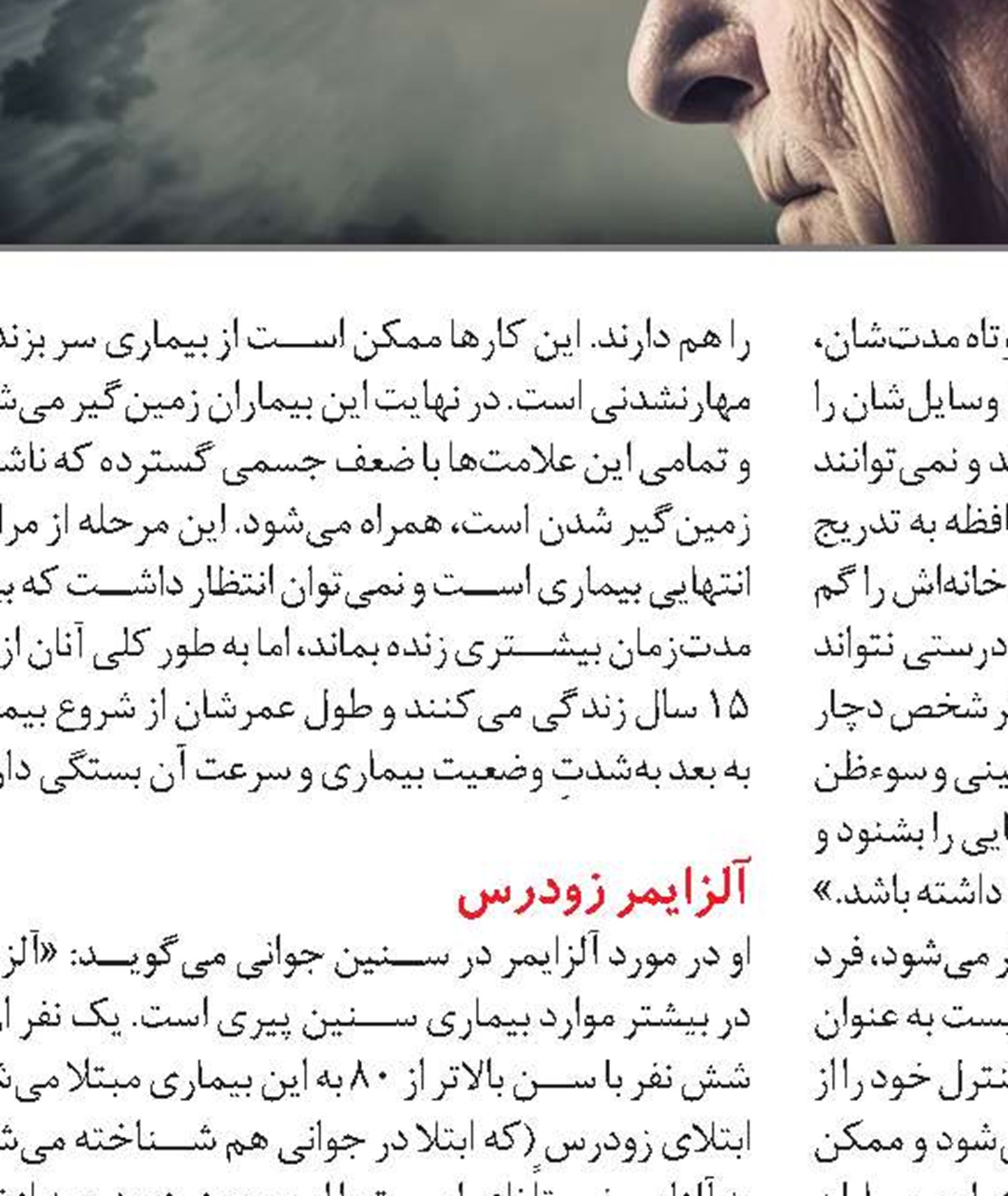 رژیم غذایی در تغذیه سالمند آلزایمری