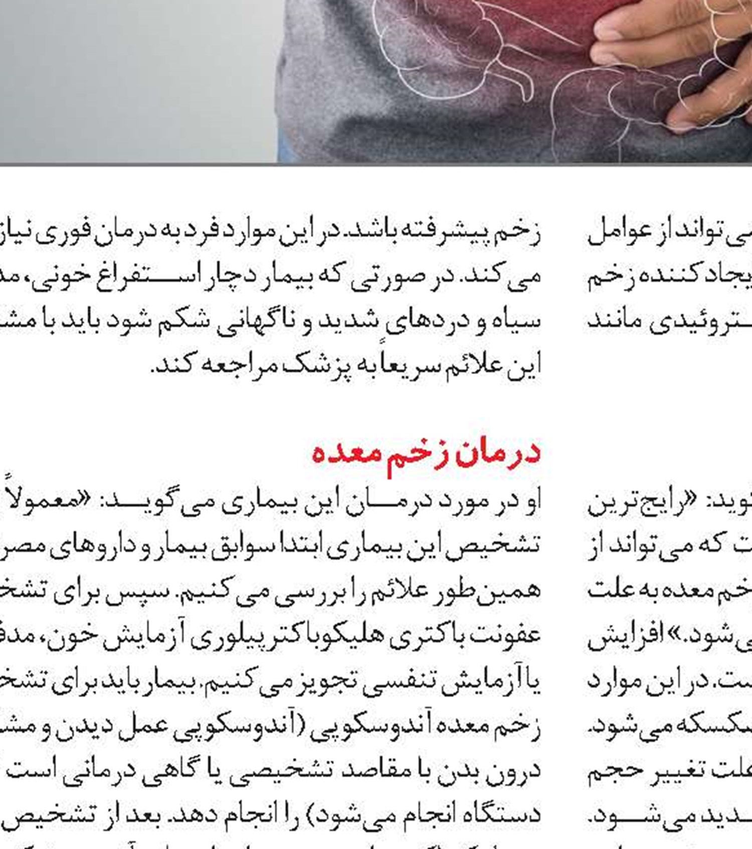 راهکارهای پیشگیری از زخم معده
