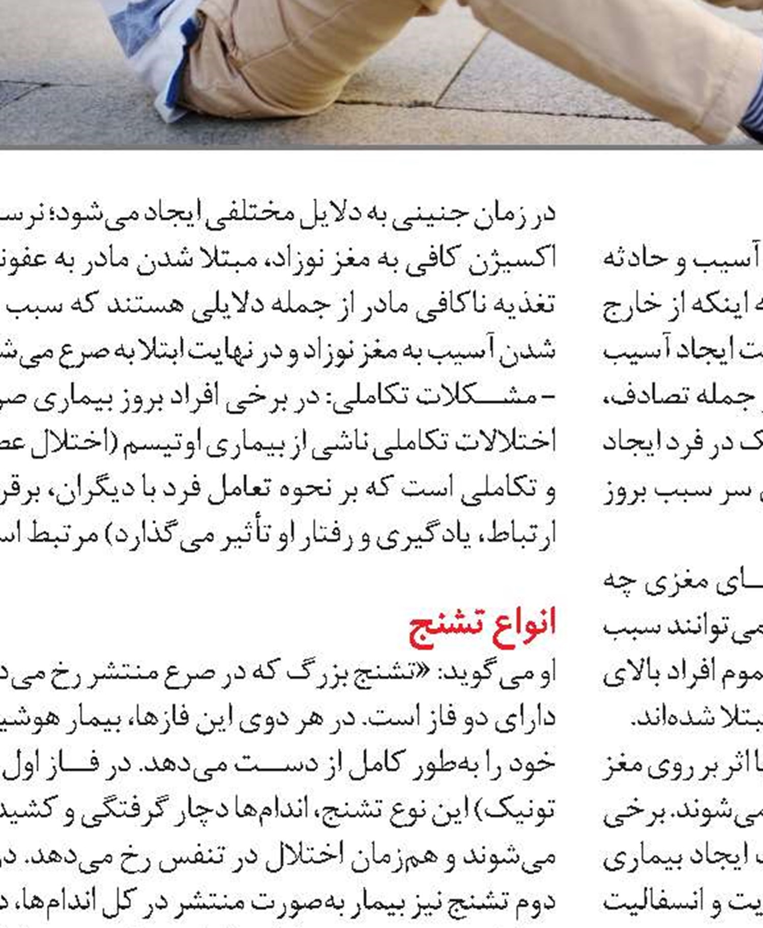 باور‌های غلط در مورد بیماری صرع