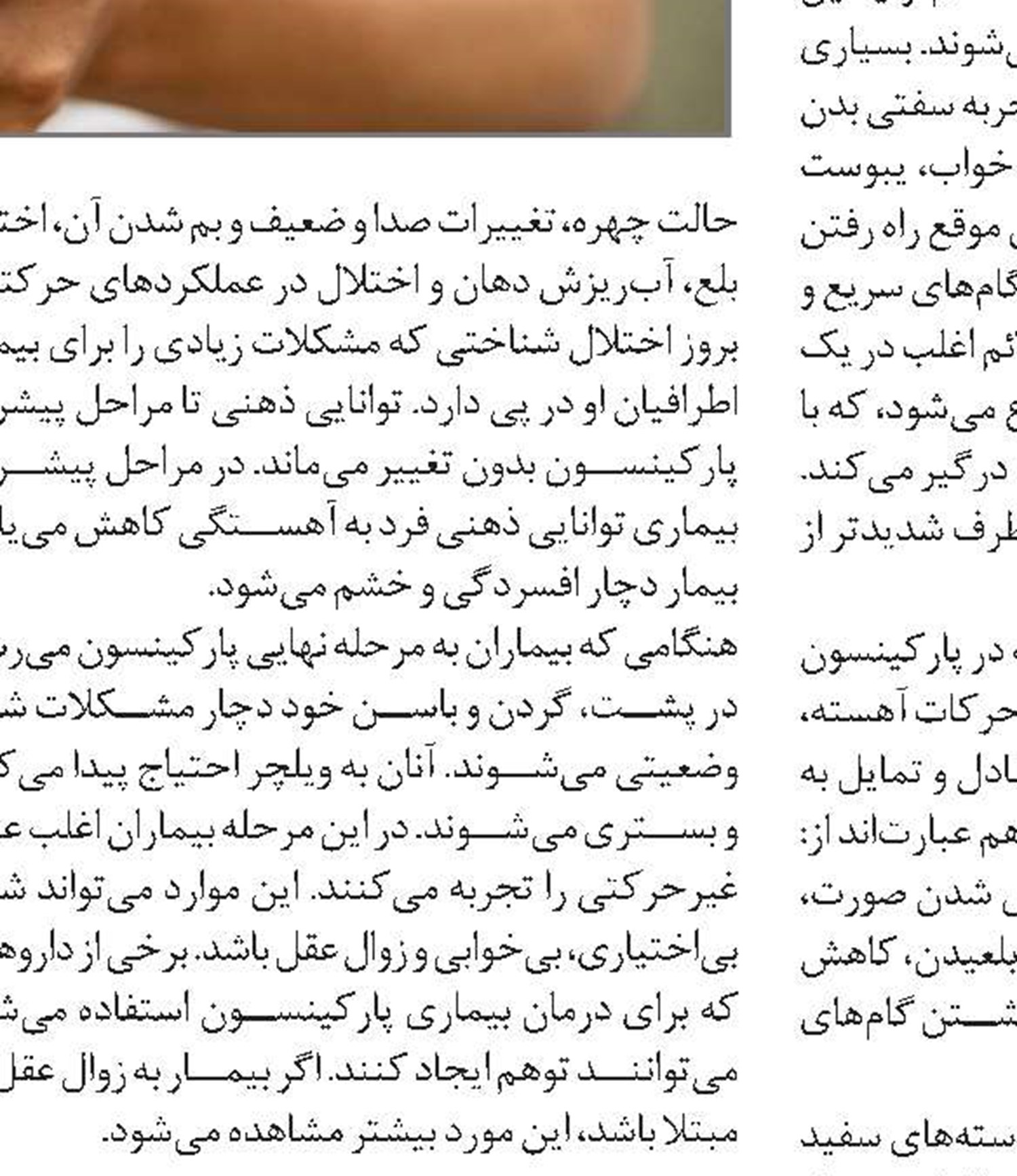 تغذیه مناسب برای بیماران مبتلا به پارکینسون