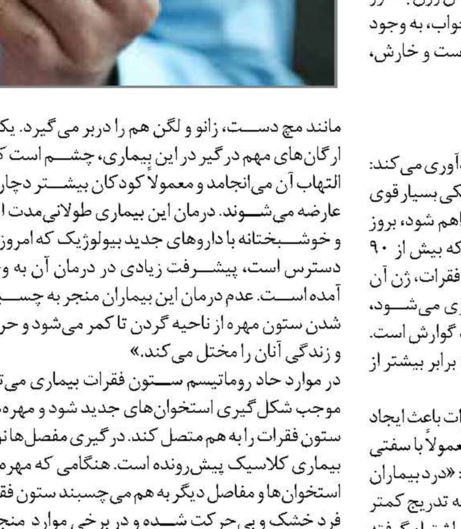 راه‌های پیشگیری از روماتیسم