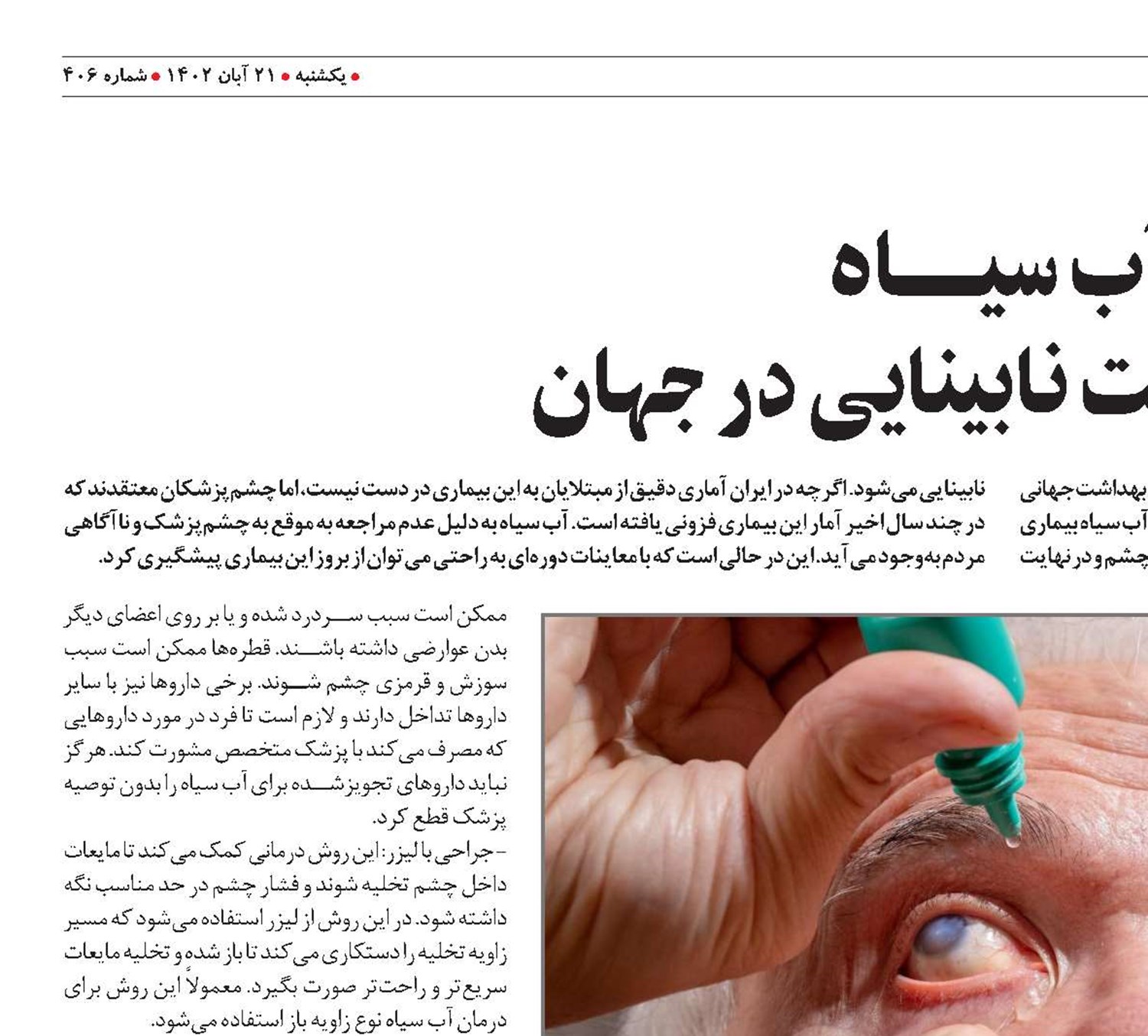 آب سیـــــاه  دومین علت نابینایی در جهان
