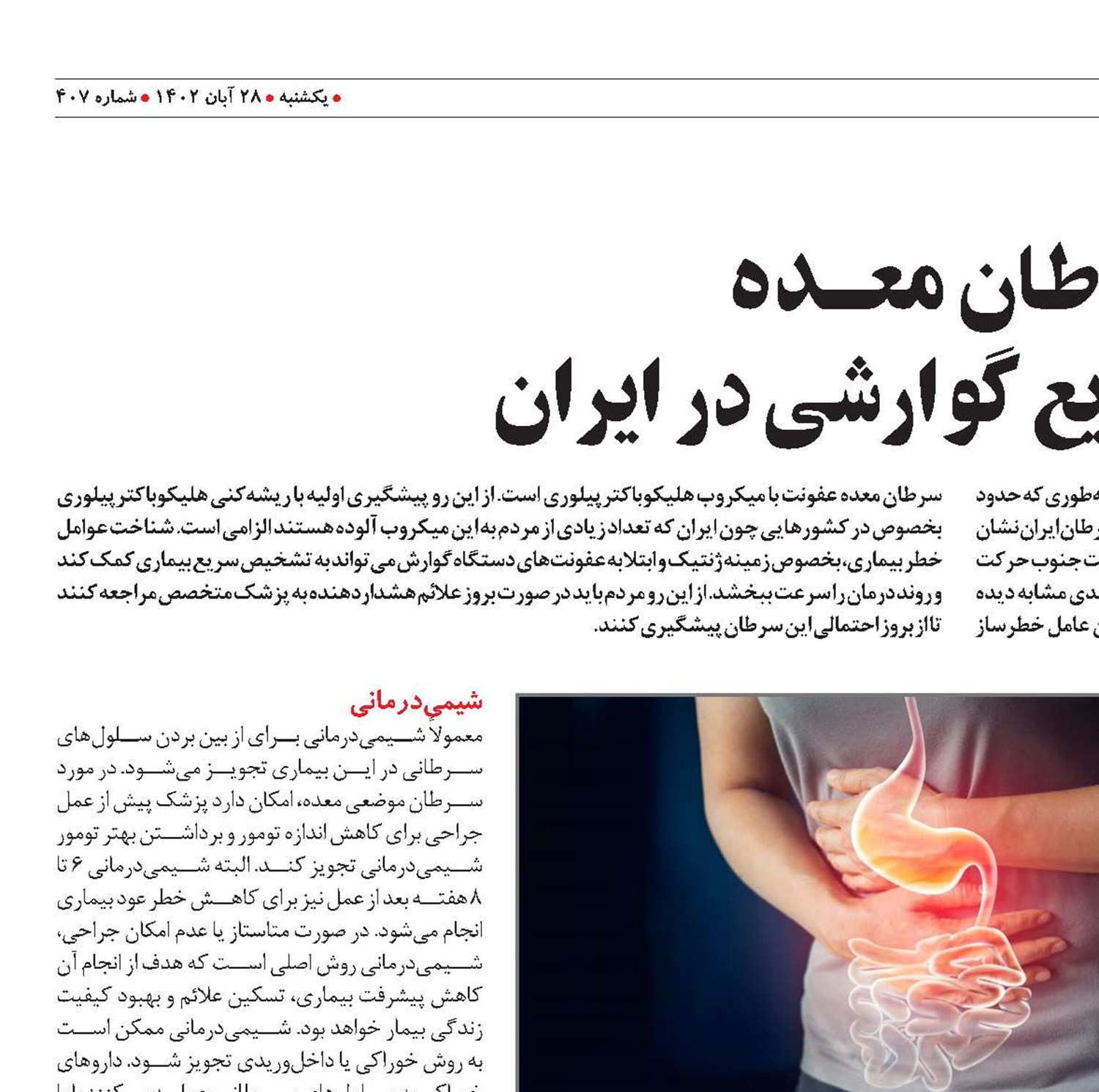 سرطان معـــده بیماری شایع گوارشی در ایران