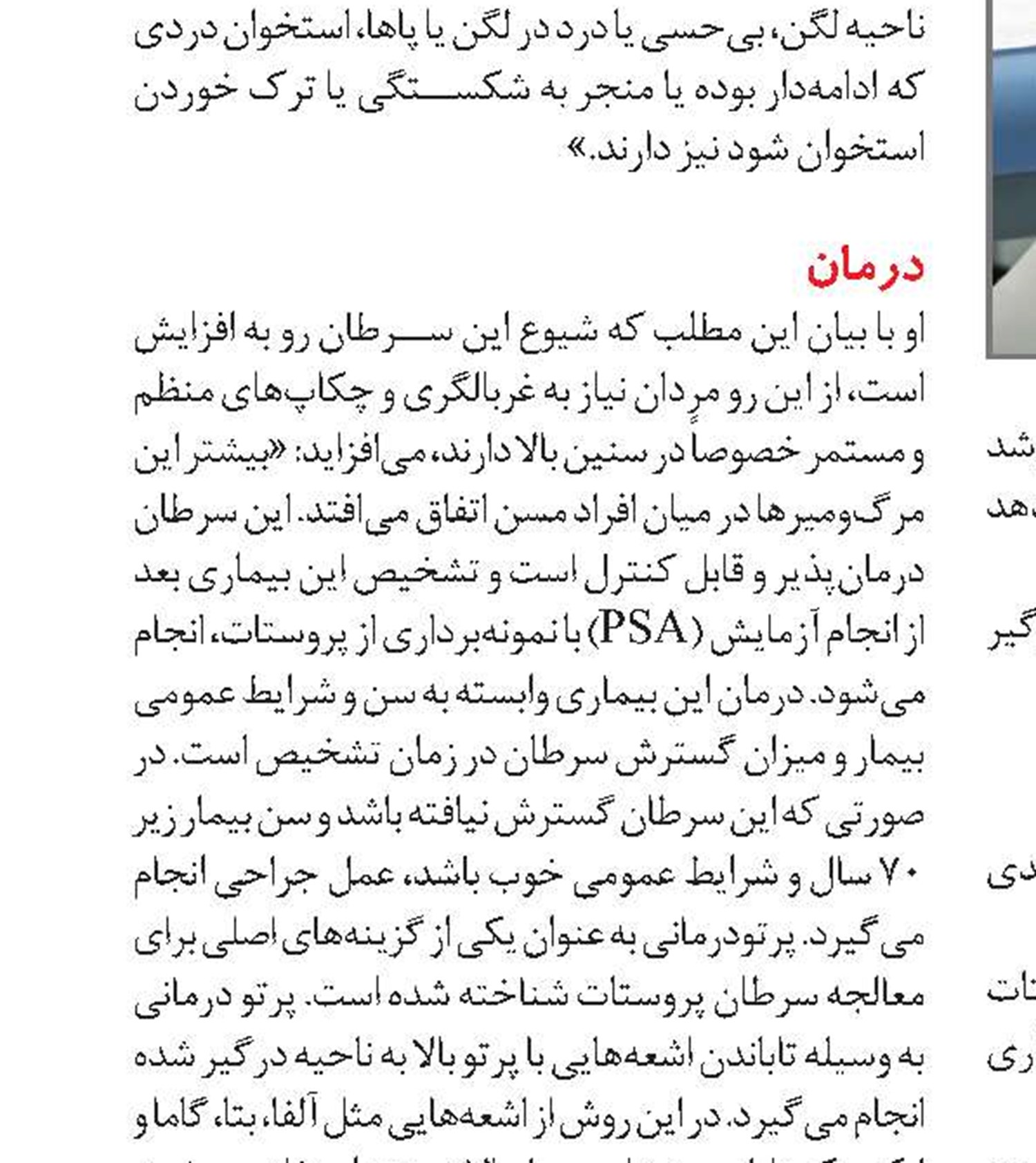 راه‌های پیشگیری از سرطان پروستات