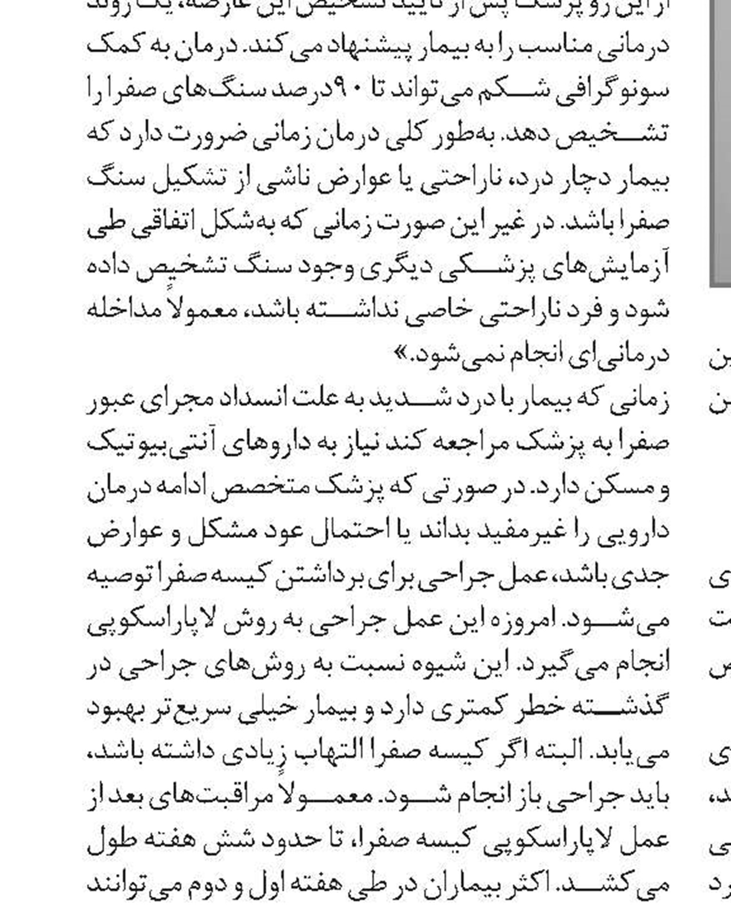 راه‌های پیشگیری از سنگ کیسه صفرا