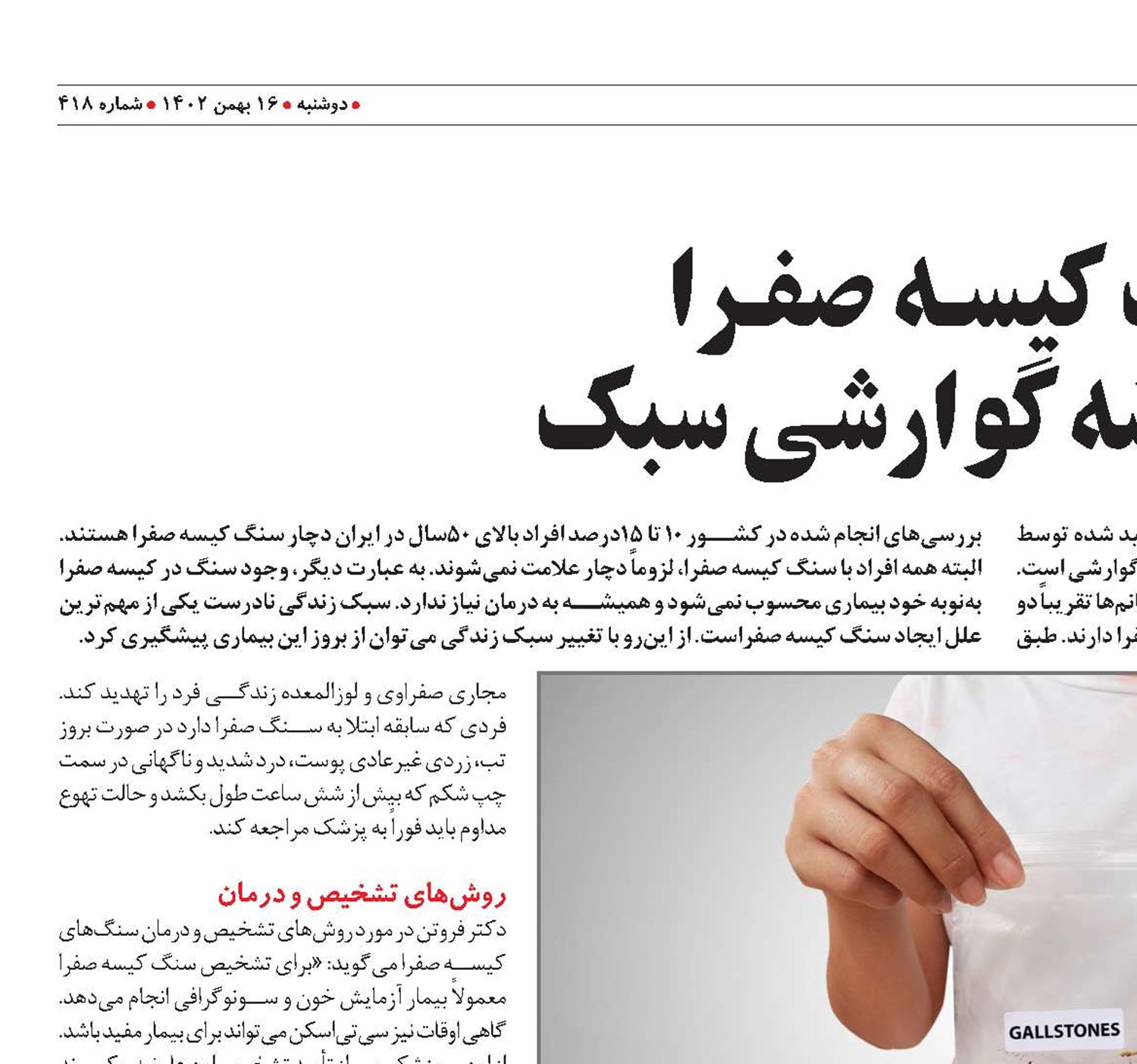 سنـگ کیسـه صفـرا یک عارضه‌ گوارشی سبک