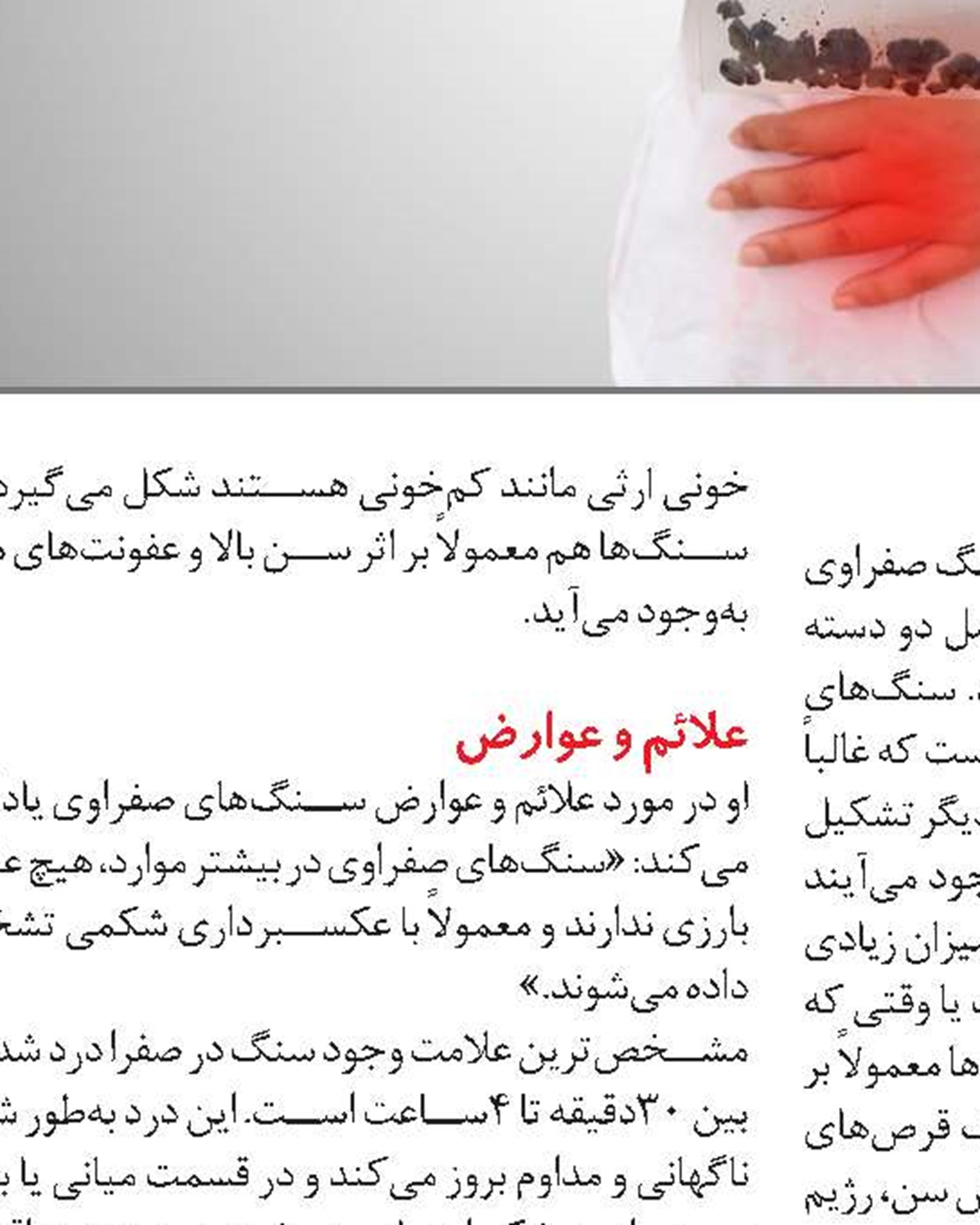 اصول تغذیه در مبتلایان به سنگ کیسه صفرا