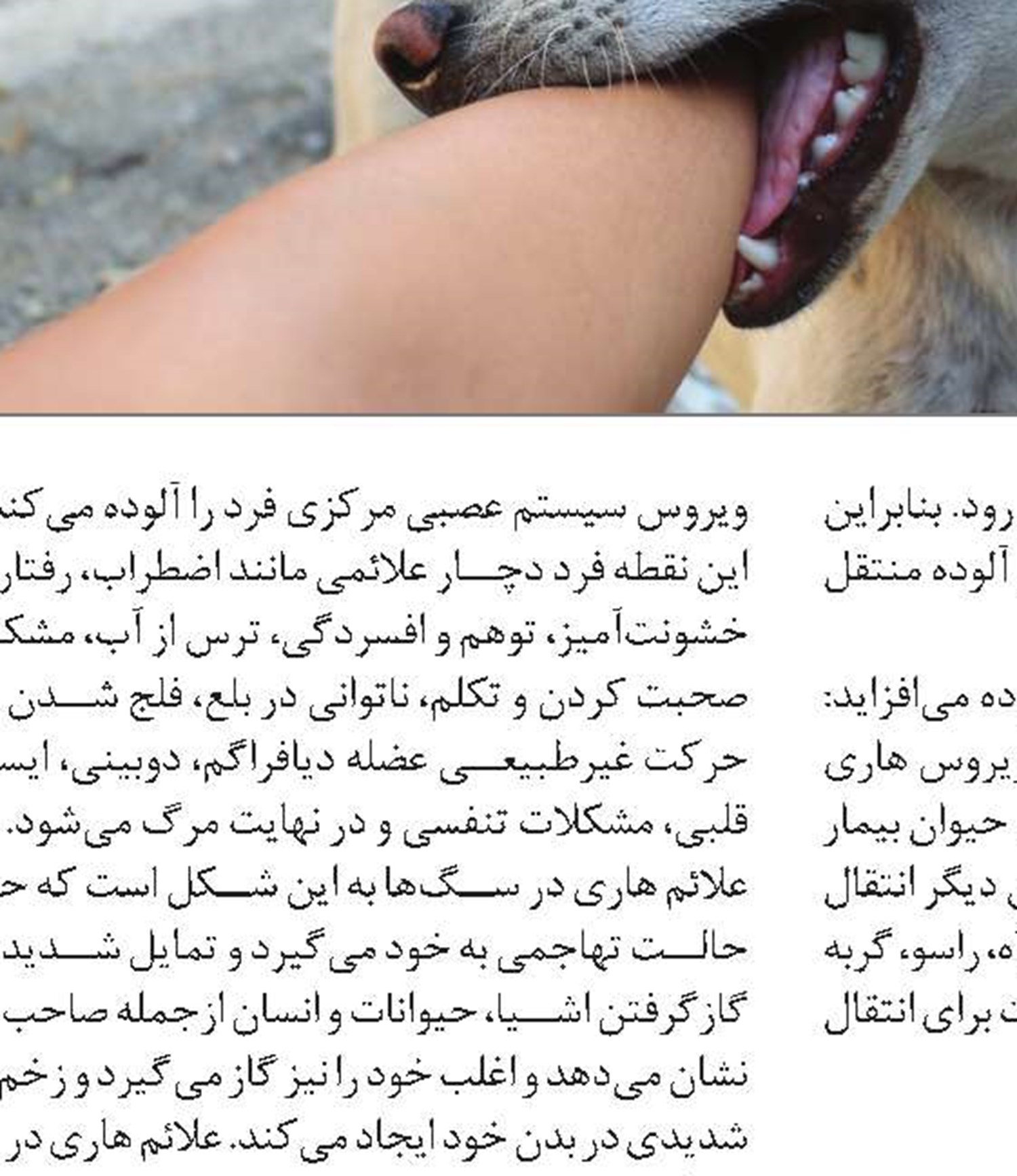 تاریخچه بیماری هاری
