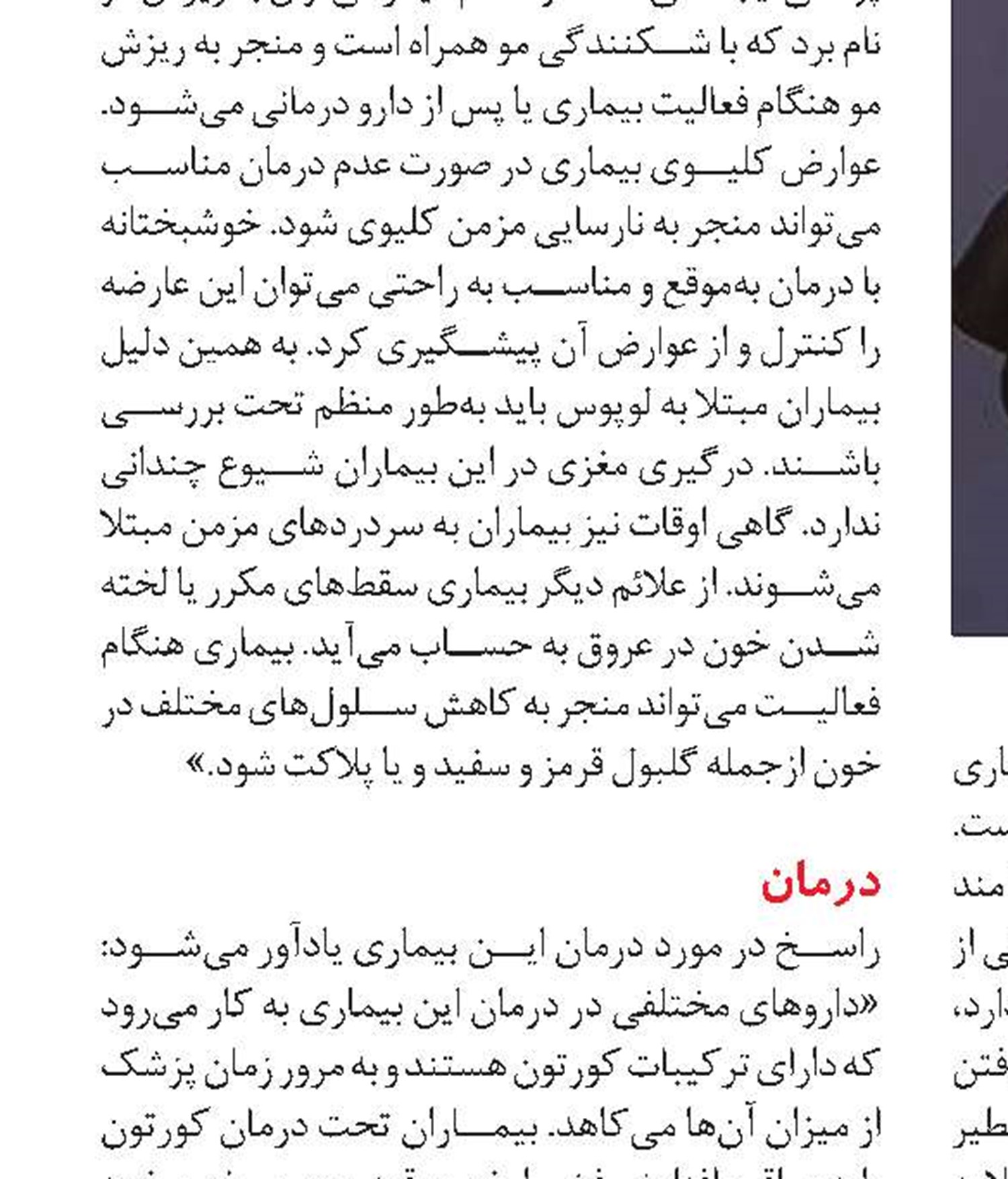 رژیم غذایی مناسب در بیماری لوپوس