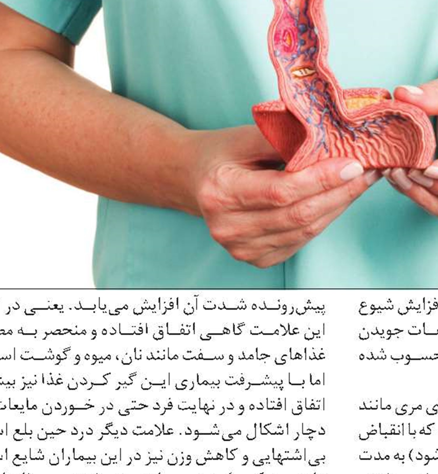 تغذیه مناسب برای مبتلایان به سرطان مری