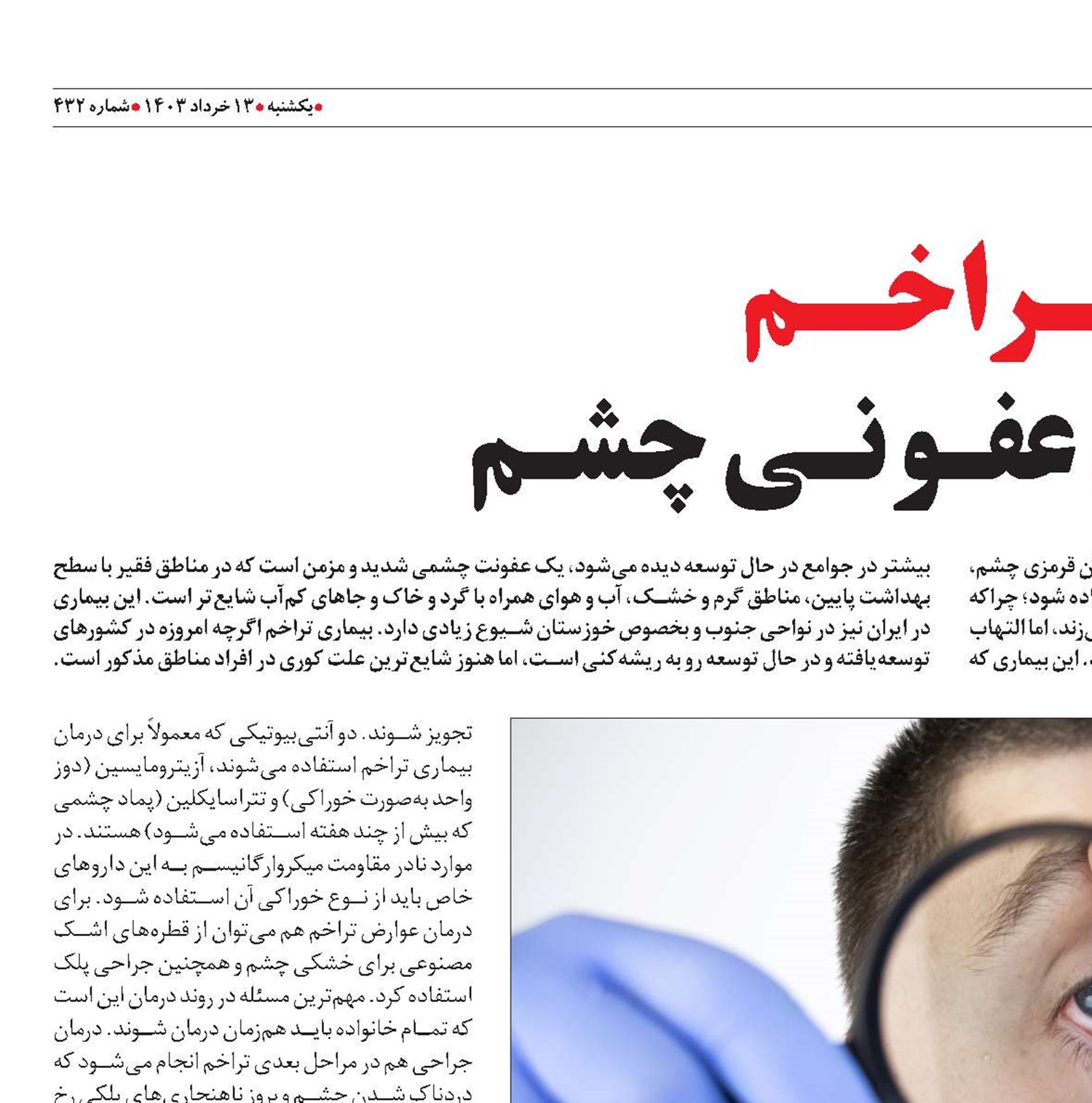 تــراخــم  بیمـاری عفـونـی چشـم