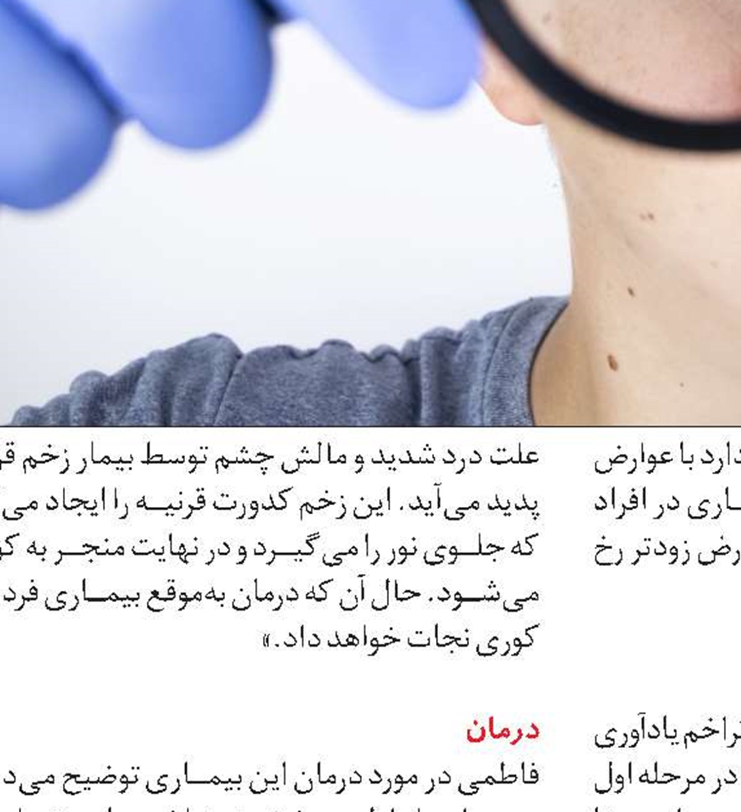 تغذیه مناسب برای چشم