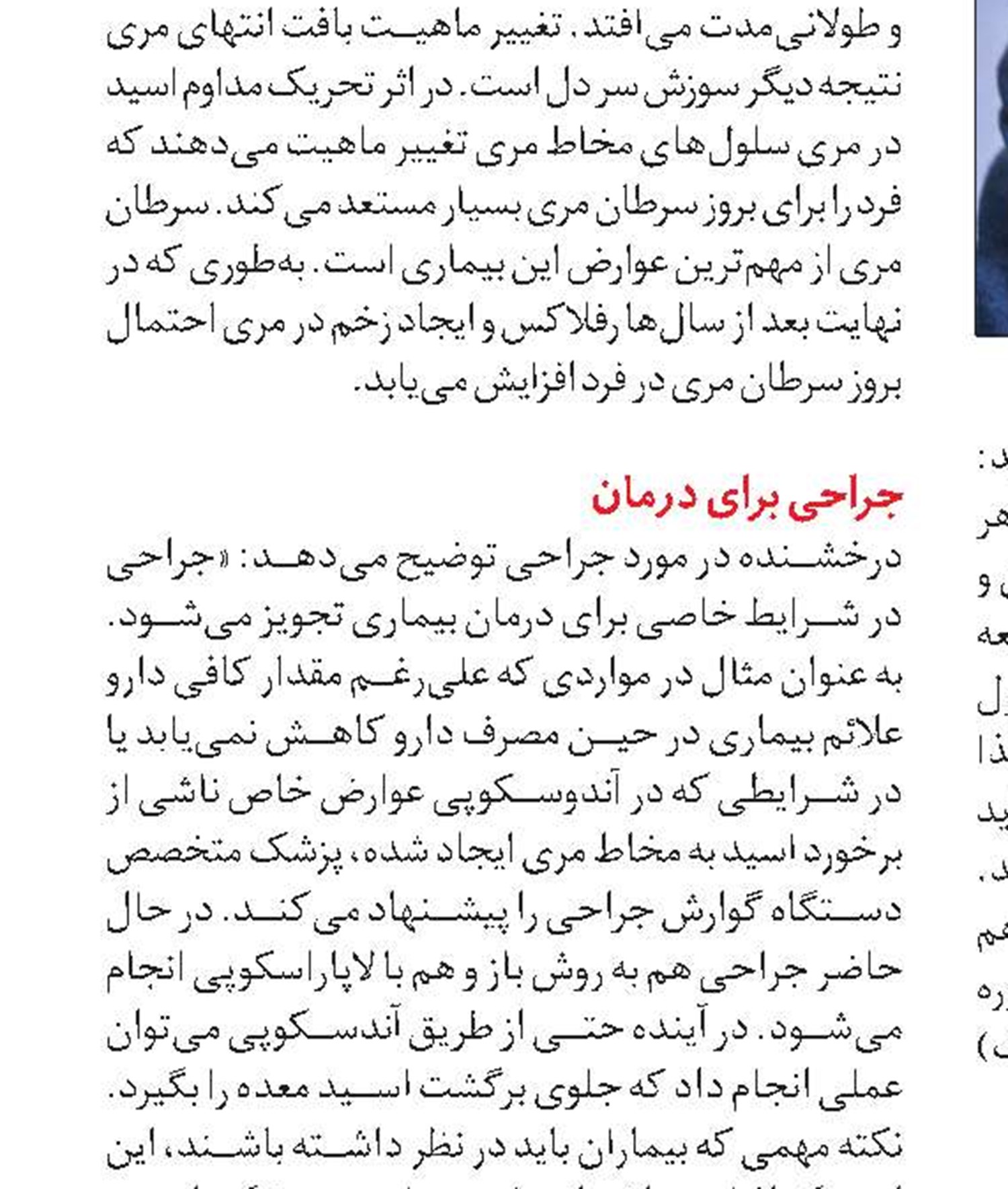 راهکارهای مفید برای کنترل اسید معده