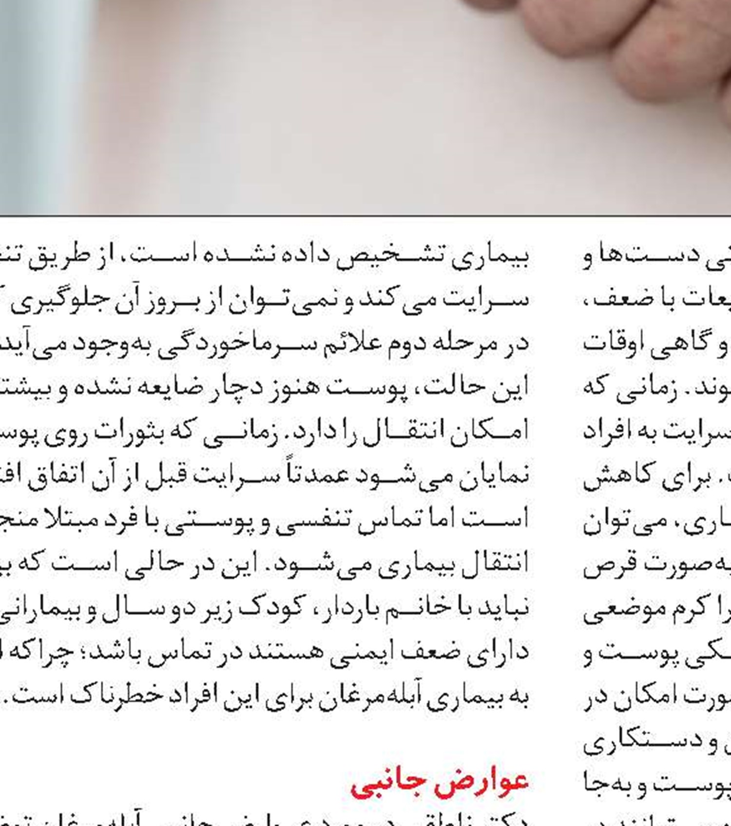 تغذیه در بیماران مبتلا به آبله‌مرغان