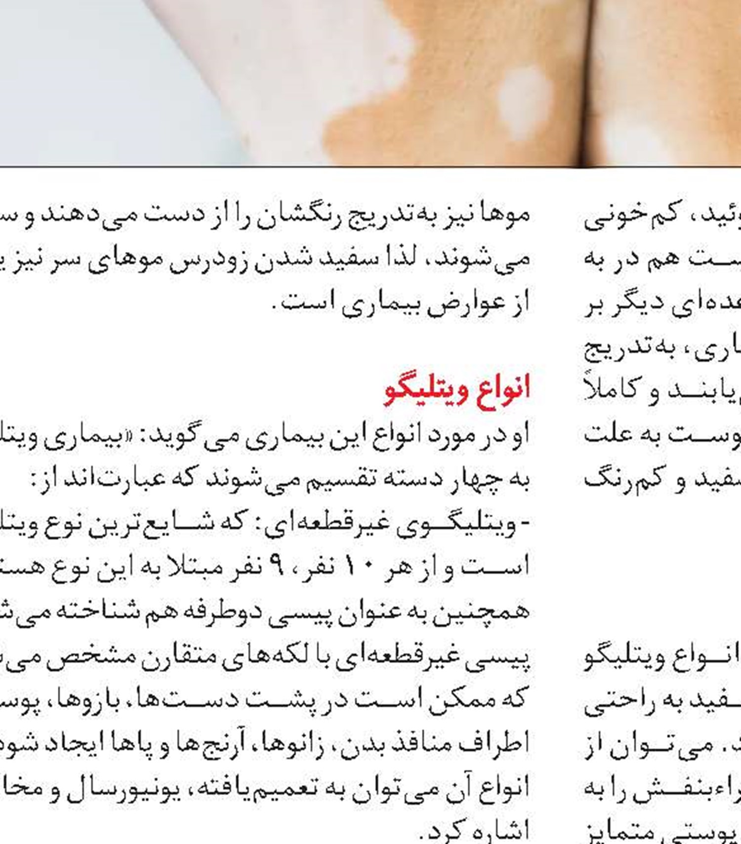 طب سنتی و ویتلیگو