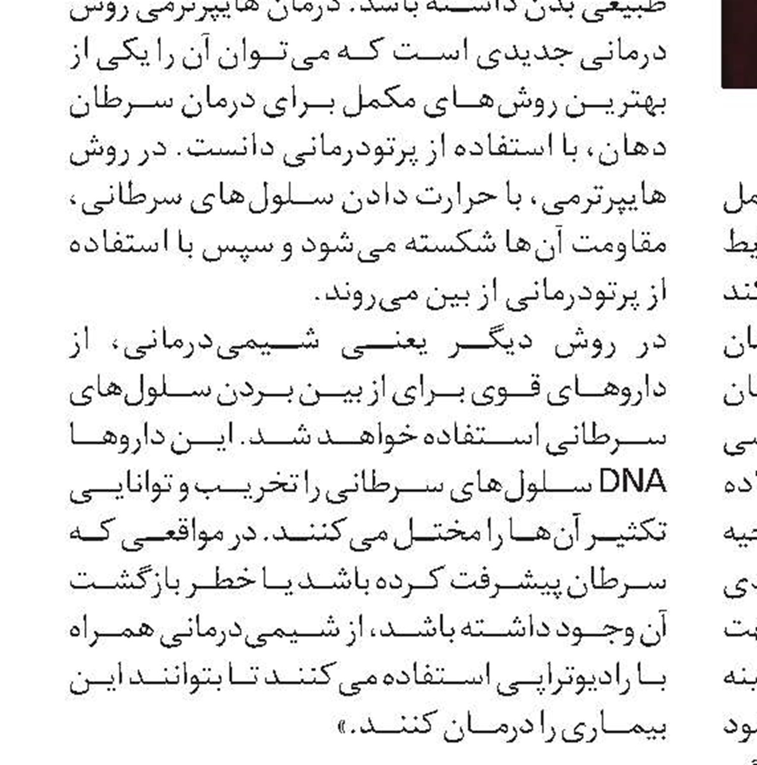 راه‌های پیشگیری از سرطان دهان