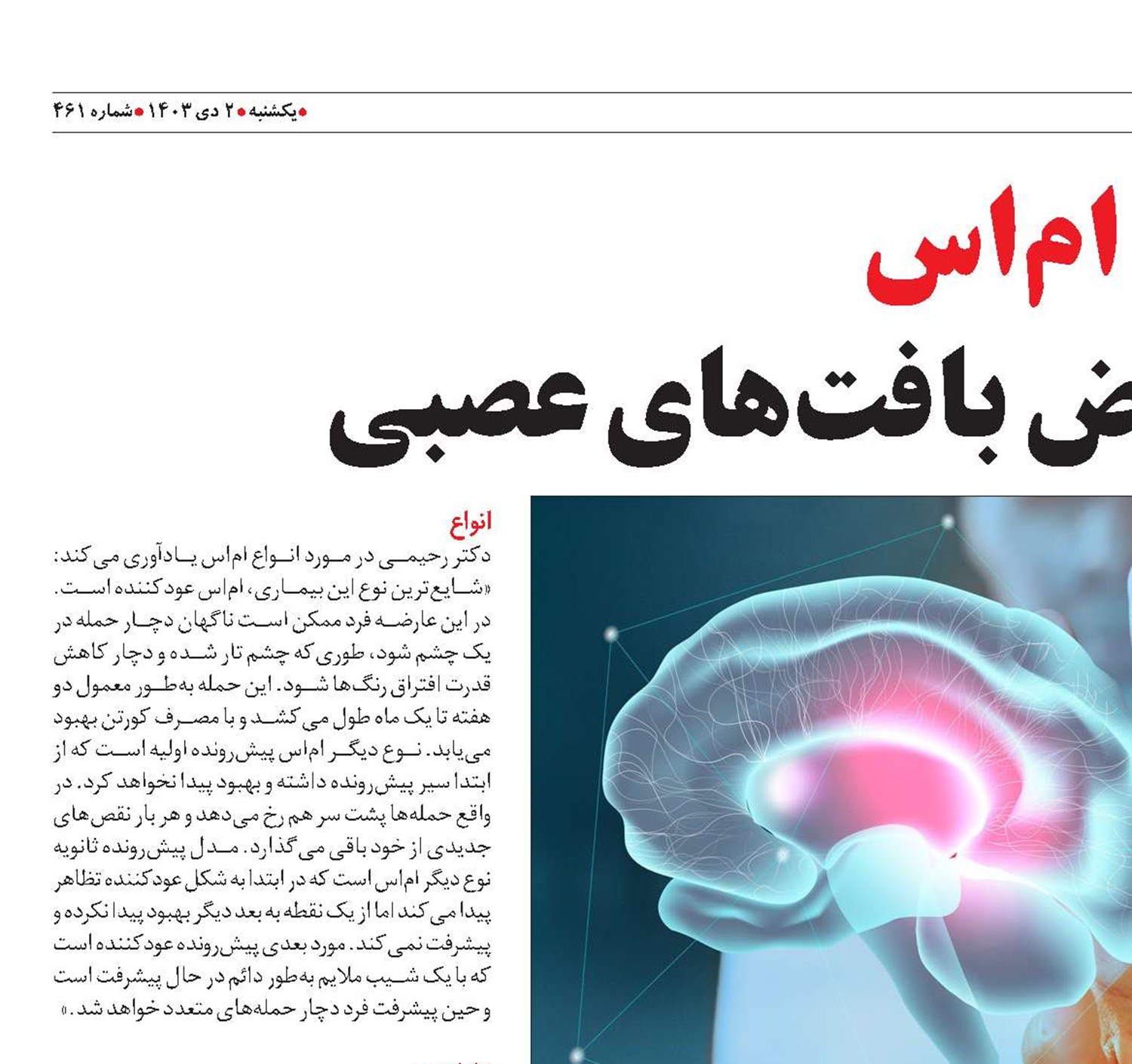 ام‌اس بیماری انقباض بافت‏های عصبی