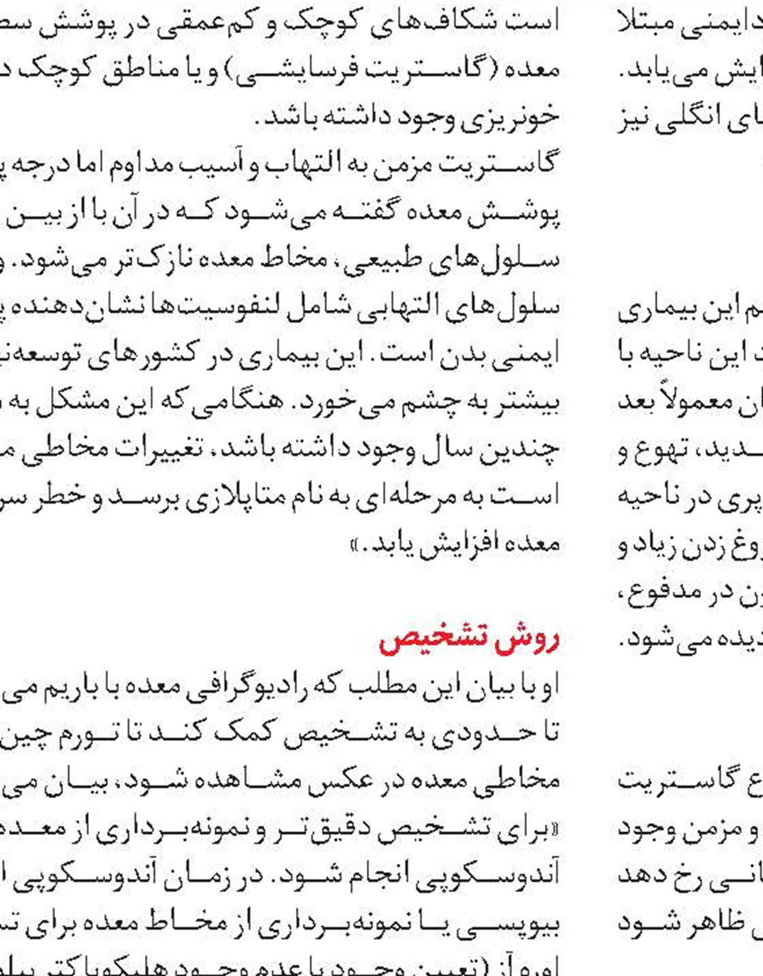 روش‌های پیشگیری از گاستریت 
