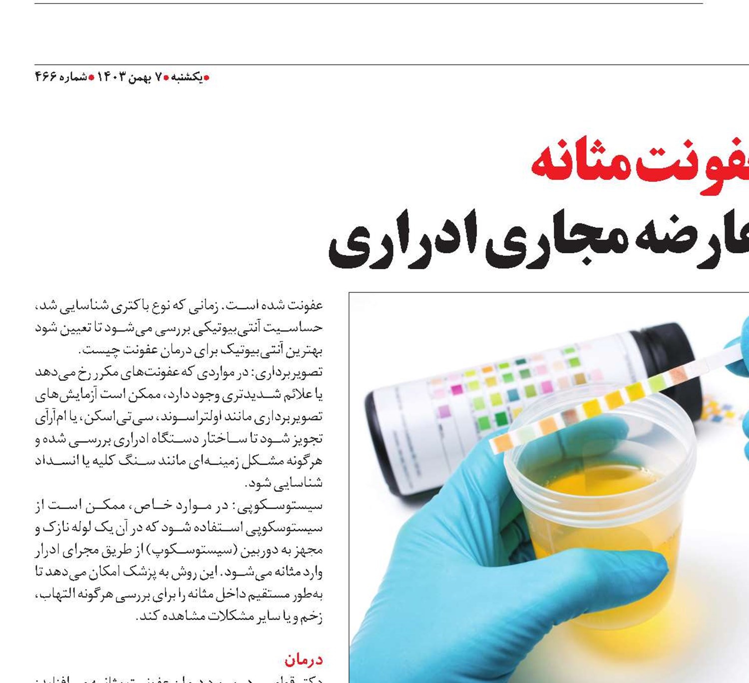 عفونت مثانه شایع‌ترین عارضه مجاری ادراری
