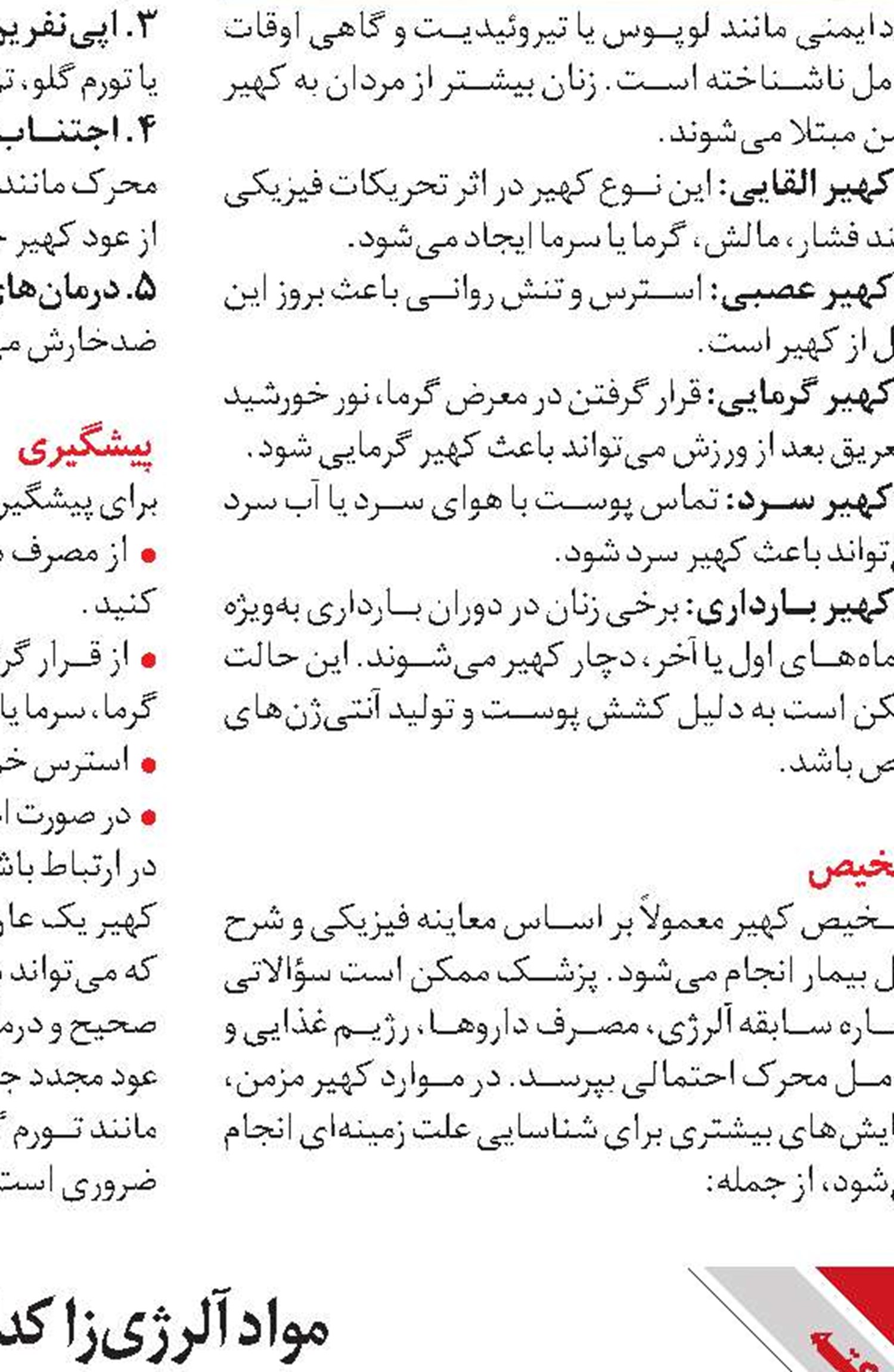 کنترل کهیر در خانه