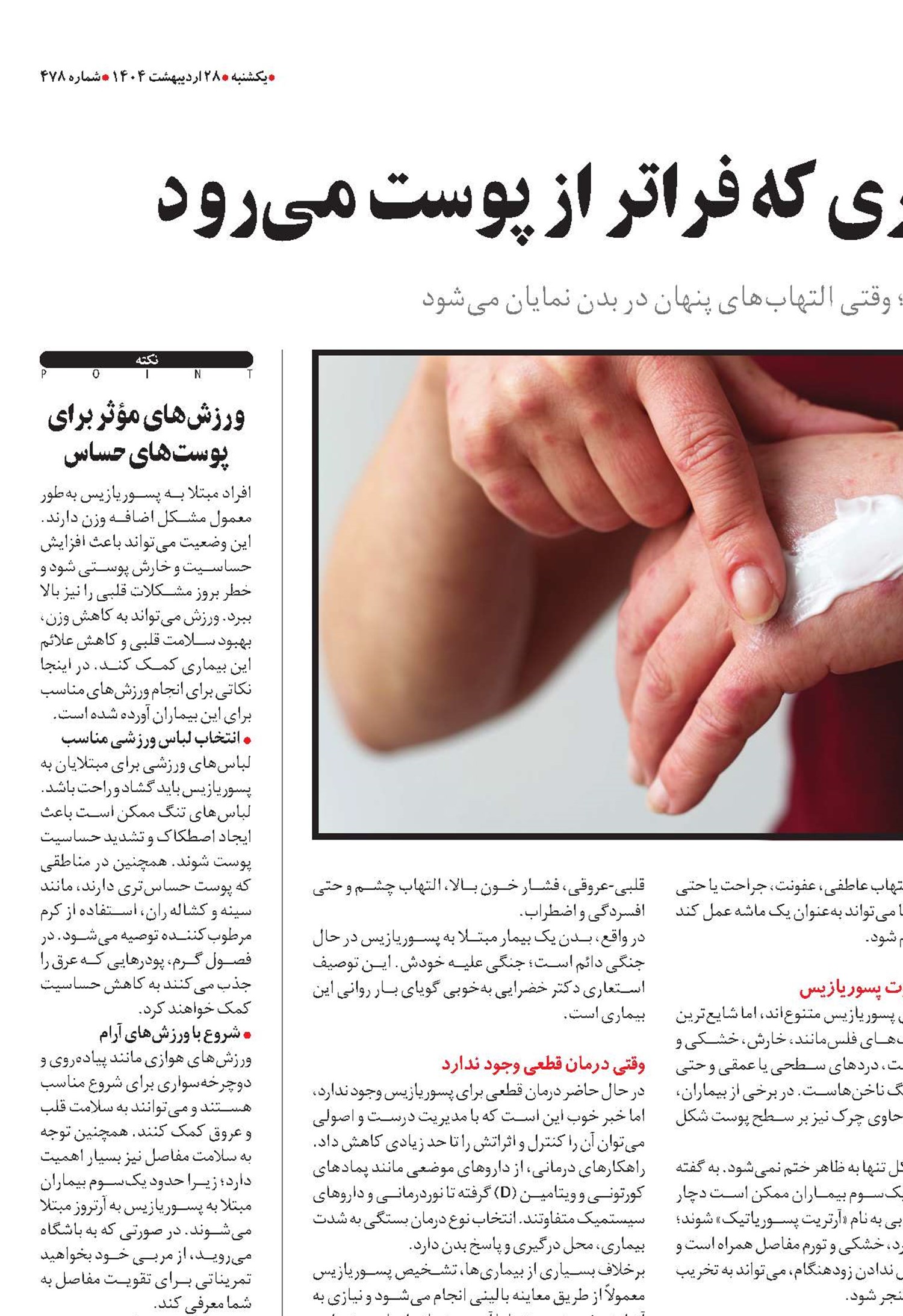 پسوریازیس؛ بیماری‌ که فراتر از پوست می‌رود