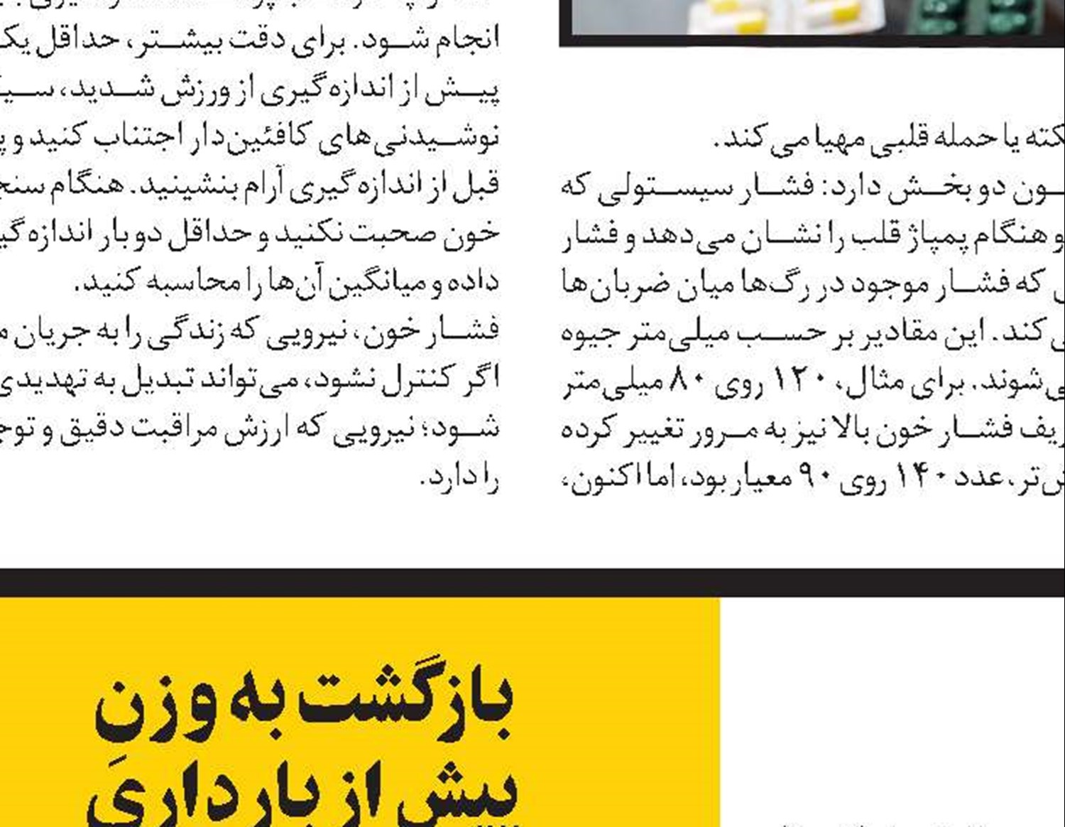 انواع تاج‌ها و روکش‌های دندانی 