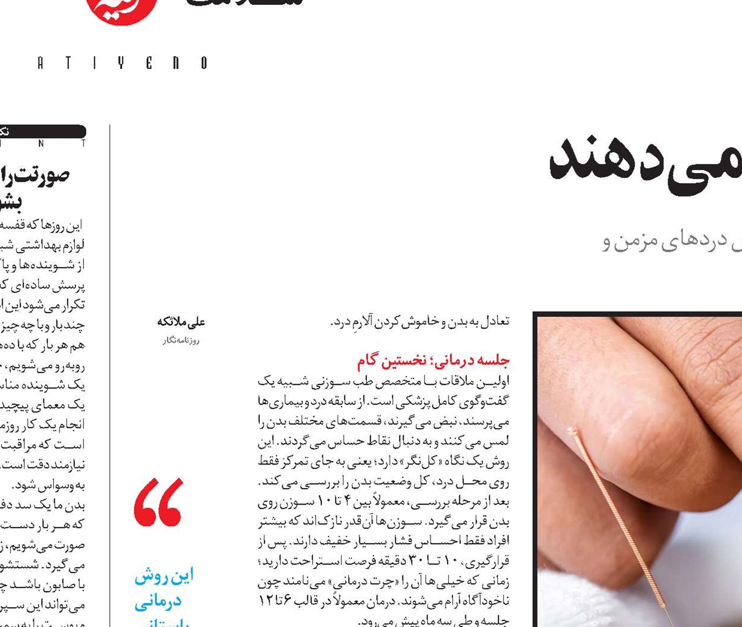 سوزن‌هایی که درد را تسکین می‌دهند