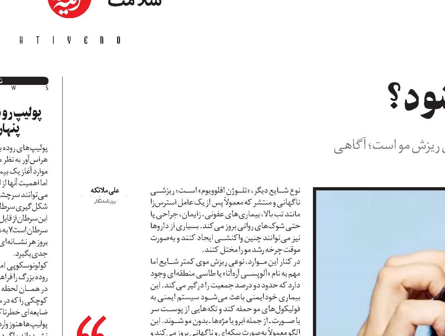 کم‌پشتی مو از کجا آغاز می‌شود؟