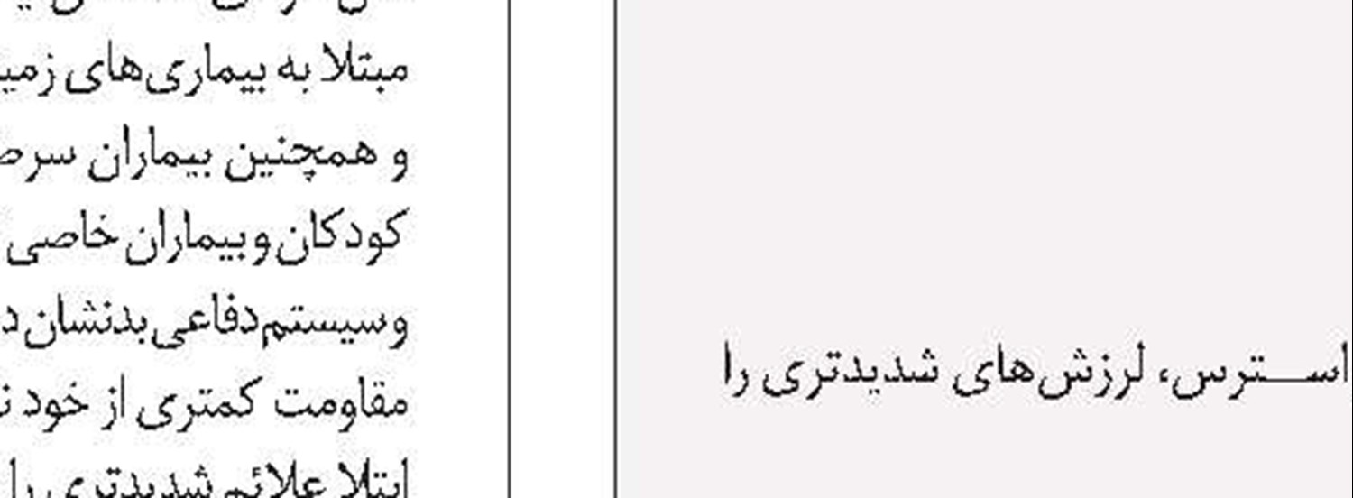 میگرن دارید؟ پنیر نخورید
